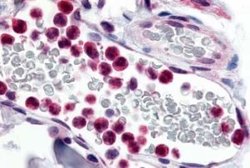 EMR3 Antibody, Novus Biologicals 50 &mu;g; Unconjugated:Antibodies, Polyclonal